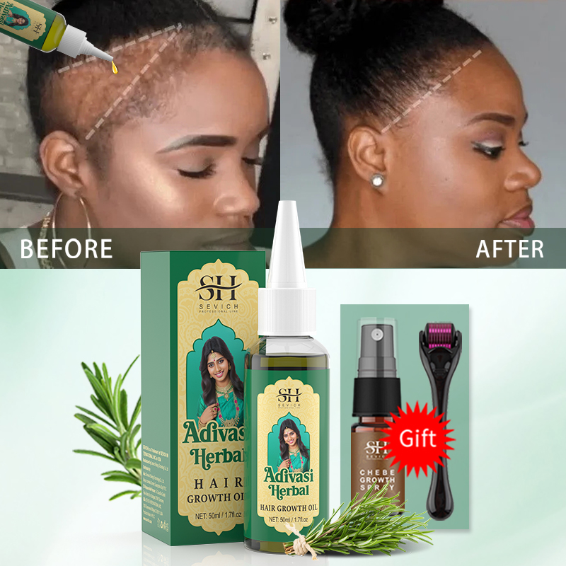 Ayurvedic Hair Growth Oil Indi – Beard Oil Growth recenzja i cena
