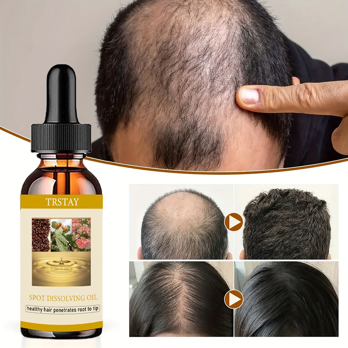 50ML Beard Growth Oil Anti Alo – Beard Oil Growth recenzja i cena