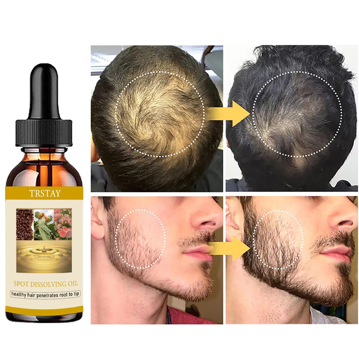50ML Beard Growth Oil Anti Alo – Beard Oil Growth recenzja i cena