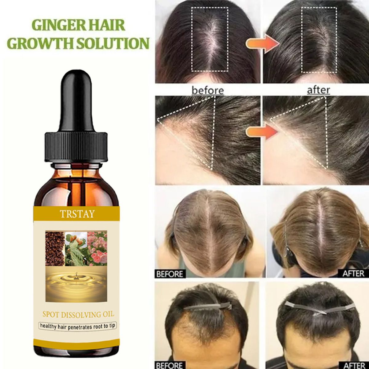 50ML Beard Growth Oil Anti Alo – Beard Oil Growth recenzja i cena