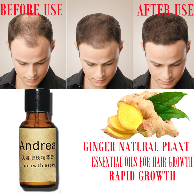 2/5/10Pcs Andrea Hair Growth S – Beard Oil Growth recenzja i cena