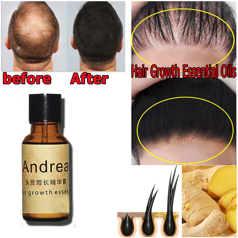 2/5/10Pcs Andrea Hair Growth S – Beard Oil Growth recenzja i cena